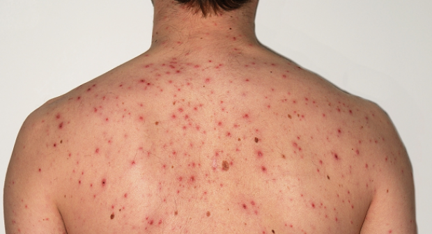 -1tnjv1exsetej6ojfjn7hqb9qy0vbuahe5lkiypzk82s