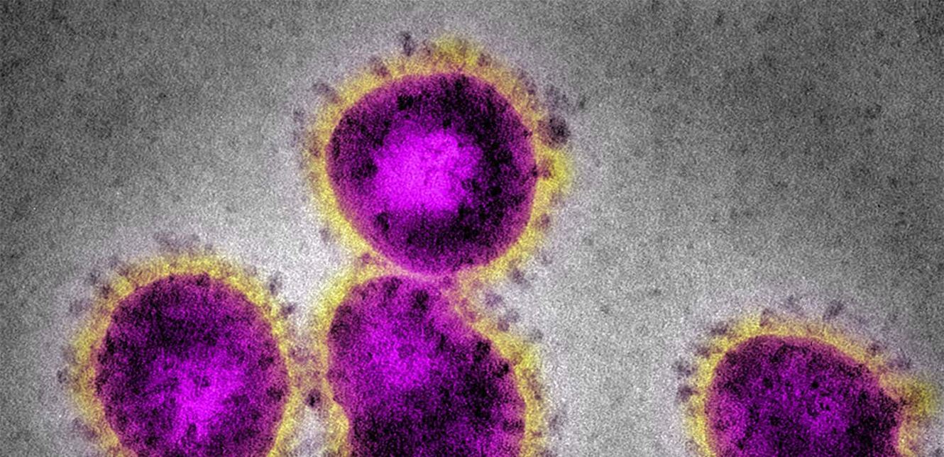 Doc-P-689343-637213528859035500