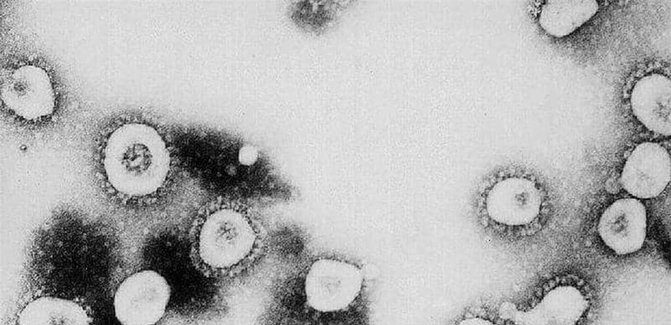 Doc-P-690569-637216743795694544