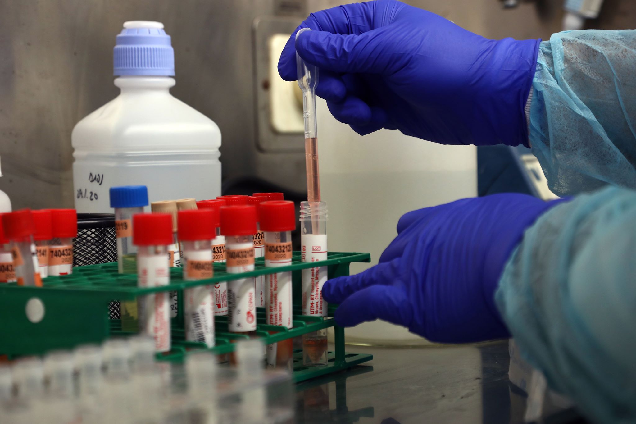 2020-05-0308_51_33.766672-77777