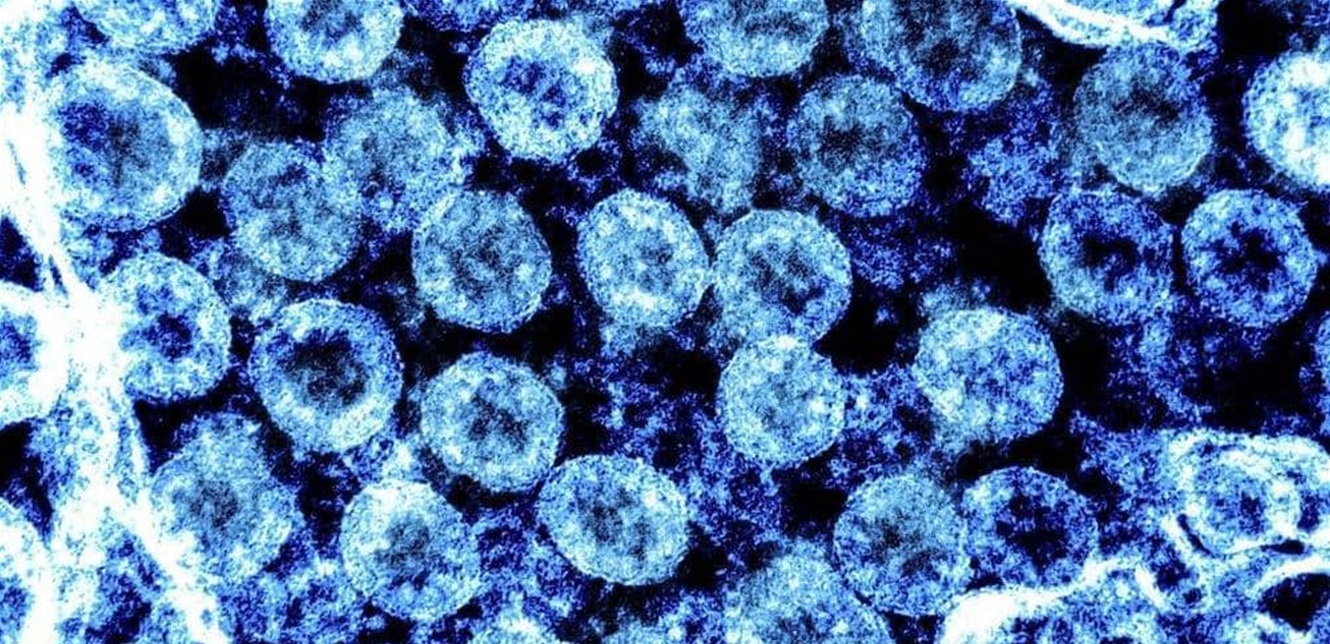 Doc-P-855900-637653041520472835