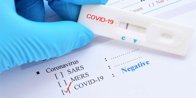 pcr-test-covid-19-048