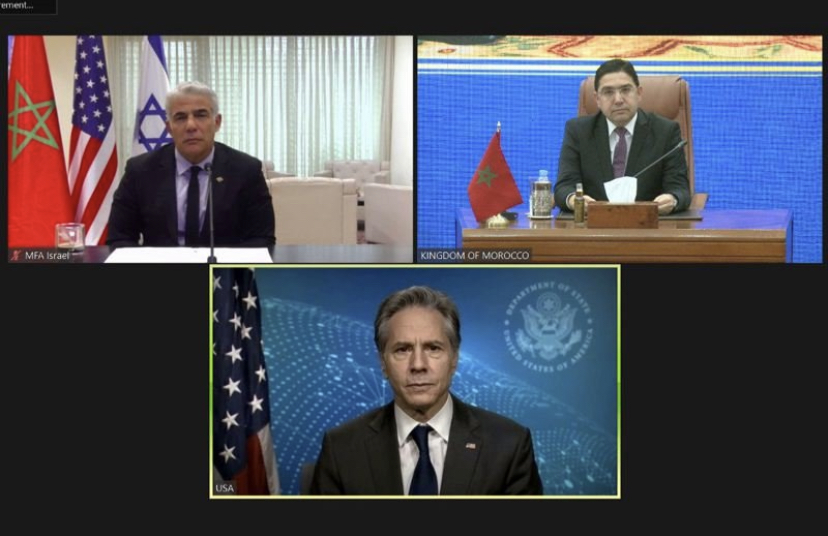 A3B41993-7E1B-4CCD-8EB4-4363D7BD7BB5